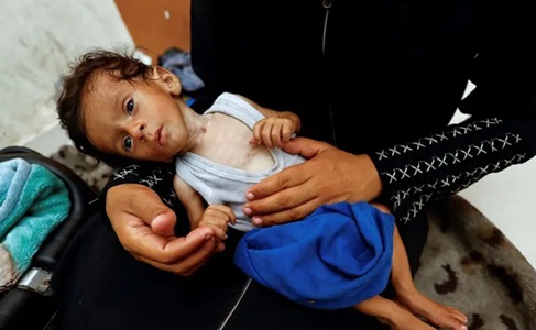 Kelaparan Parah di Gaza, Save Children: Anak-anak Bagitu Lemah Bahkan untuk Menangis